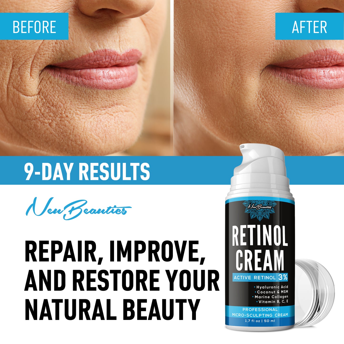 Retinol Cream 3%